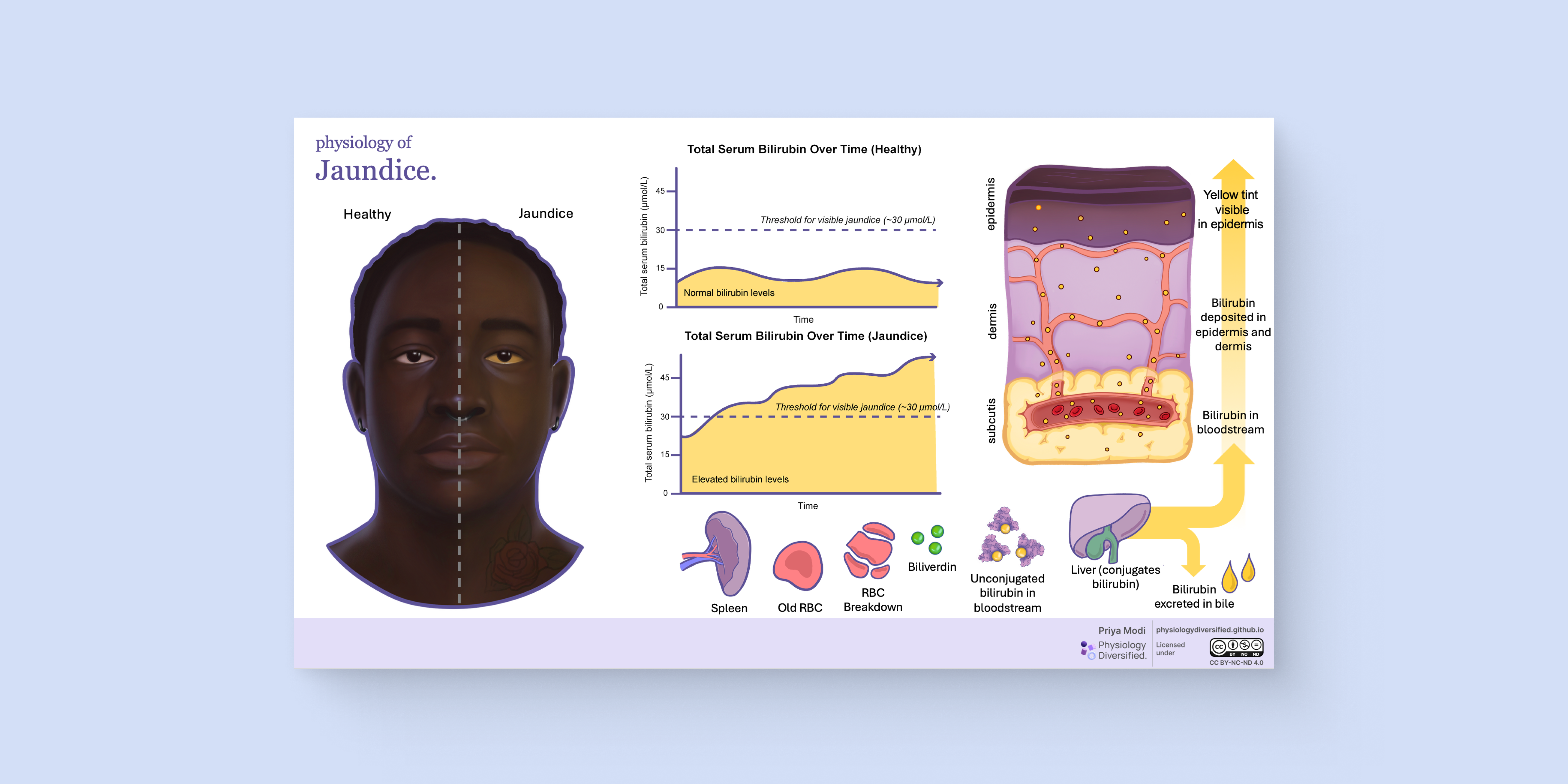 Physiology of Jaundice
